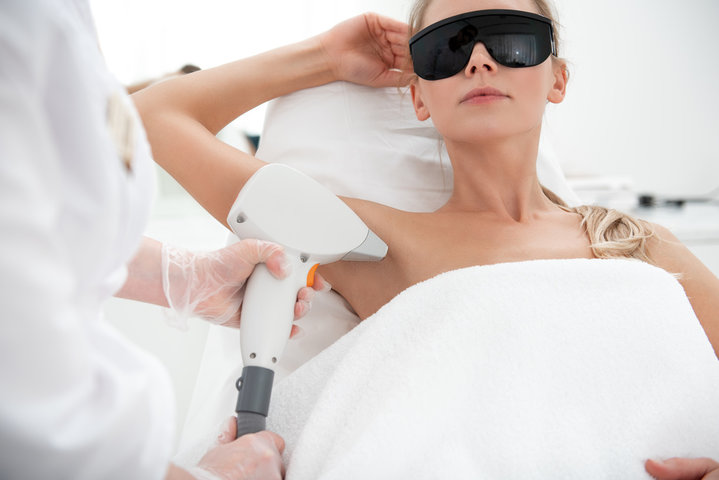 Laser hair removal